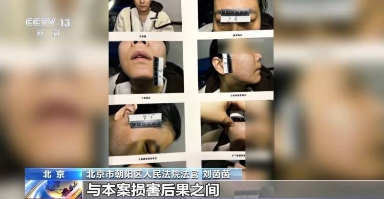 皇冠信用网代理占成
_打美容针竟致十级伤残皇冠信用网代理占成
！在医生家中做医美 出了事谁负责？